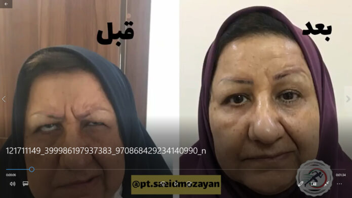 فلج