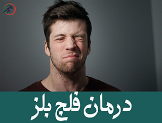 درمان فلج بلز
