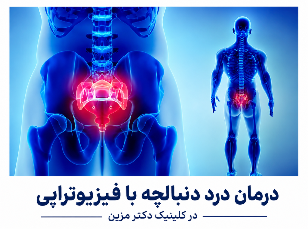 درمان درد دنبالچه با فیزیوتراپی